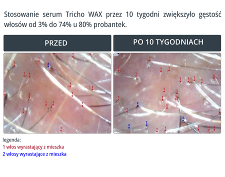 Serum na wypadanie włosów bez spłukiwania TRICHO WAX 100ml